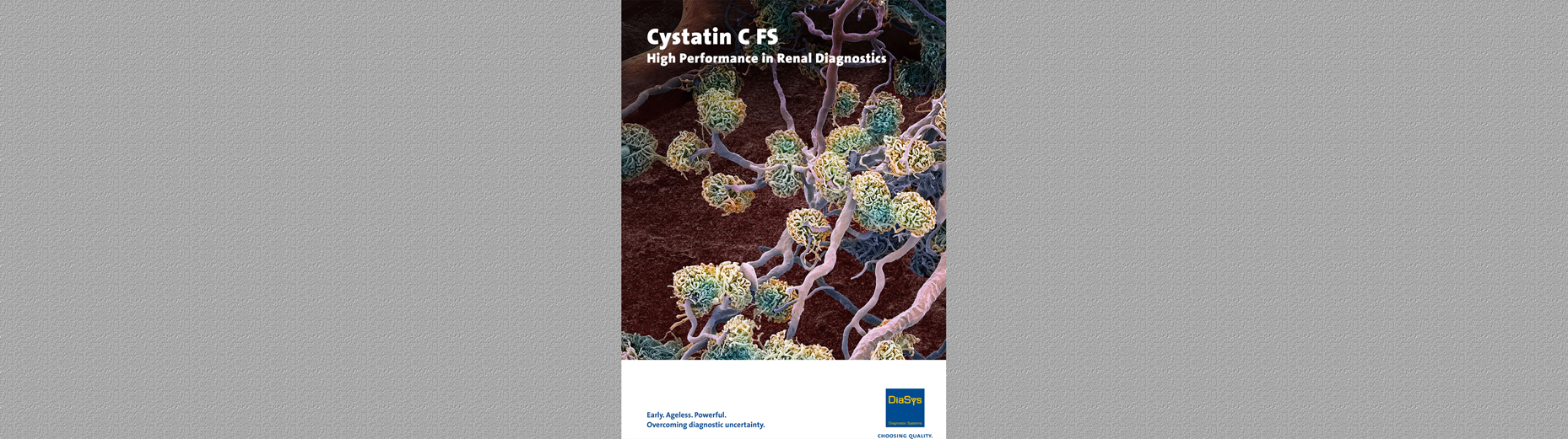 Cystatin C FS Brochure
