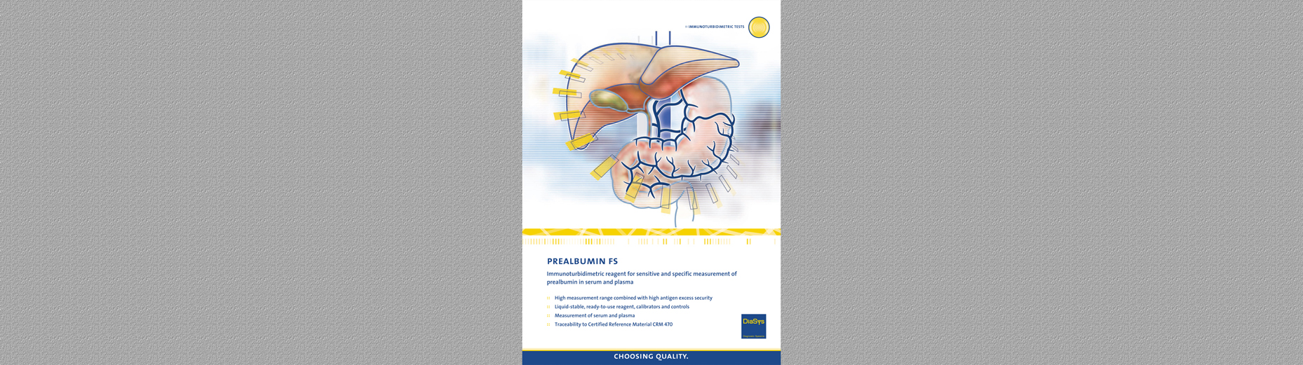 Prealbumin Brochure